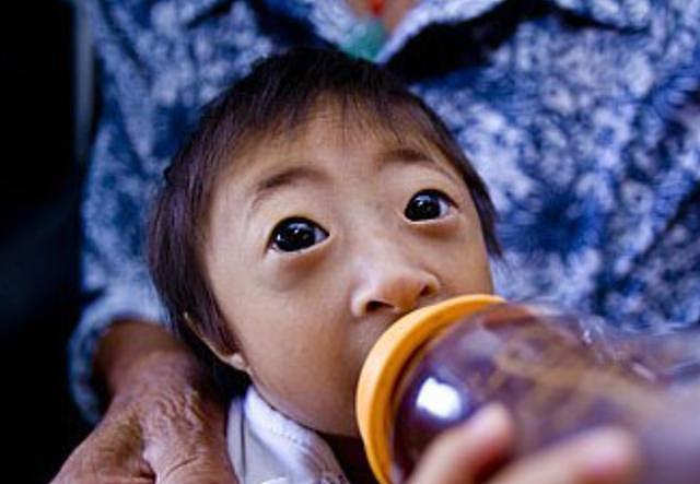 2009年，湖南女子生下2斤袖珍女婴，长相像猴子，马戏团出5万求购 - 22