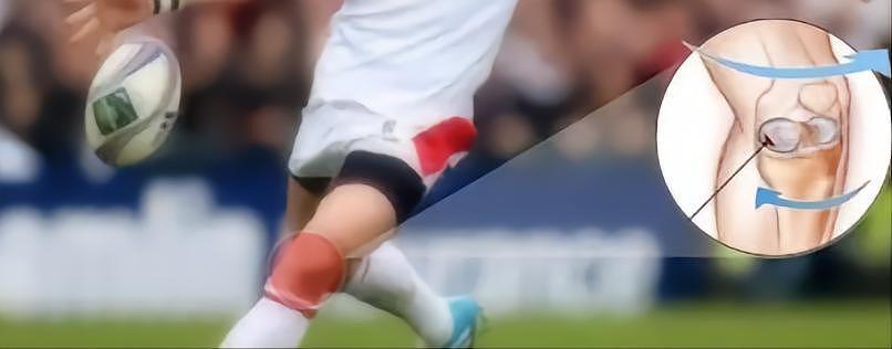 膝盖中间的小软骨，是改变球员职业生涯的噩梦 - 1