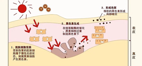 原来大家最头疼的肤色问题是这些！ - 1