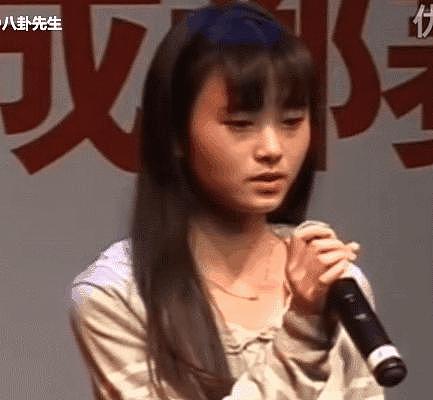 整容脸变大帅哥，“猪鼻子”变美女，这些明星二次整容变得更好看 - 13