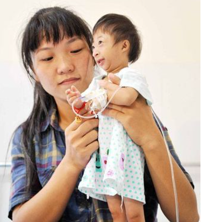 2009年，湖南女子生下2斤袖珍女婴，长相像猴子，马戏团出5万求购 - 10