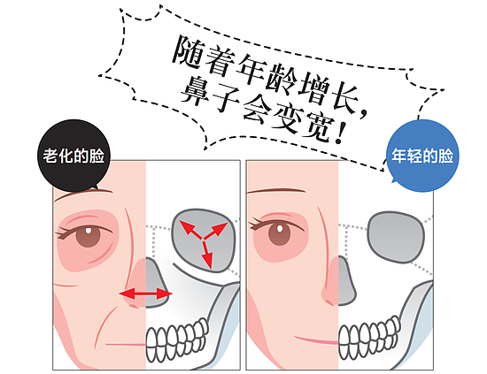 脸部老化对策 从“鼻”开始是捷径！ - 3