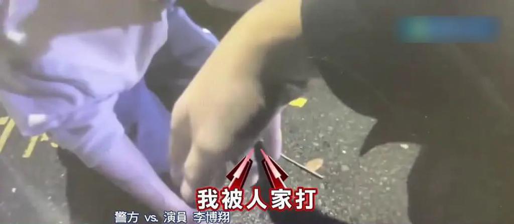 男星李博翔在街头被毒打伤势严重，女友上前劝架也遭殃 - 11