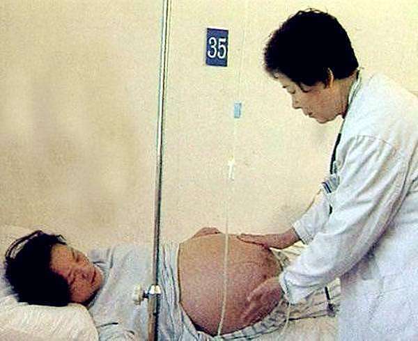 2002年，河北孕妇诞下五胞胎，后被选为奥运“福娃”，现今咋样？ - 5