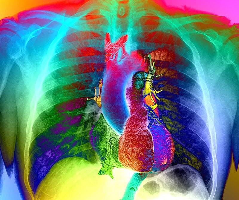 搜狐医药 | 《自然医学》：新冠肺炎康复后，20余种心血管疾病风险大幅提升 - 1