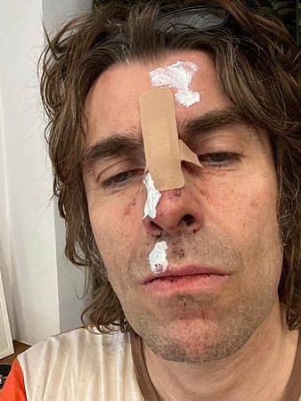 ▲▼綠洲合唱團（Oasis）連恩蓋勒格（Liam Gallagher）自稱從直升機摔下。（圖／翻攝自推特）