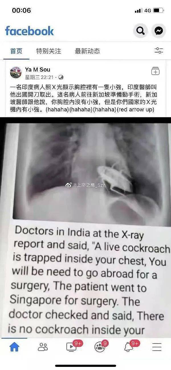 胸部X光片拍下胸腔内的活蟑螂？假的 - 1