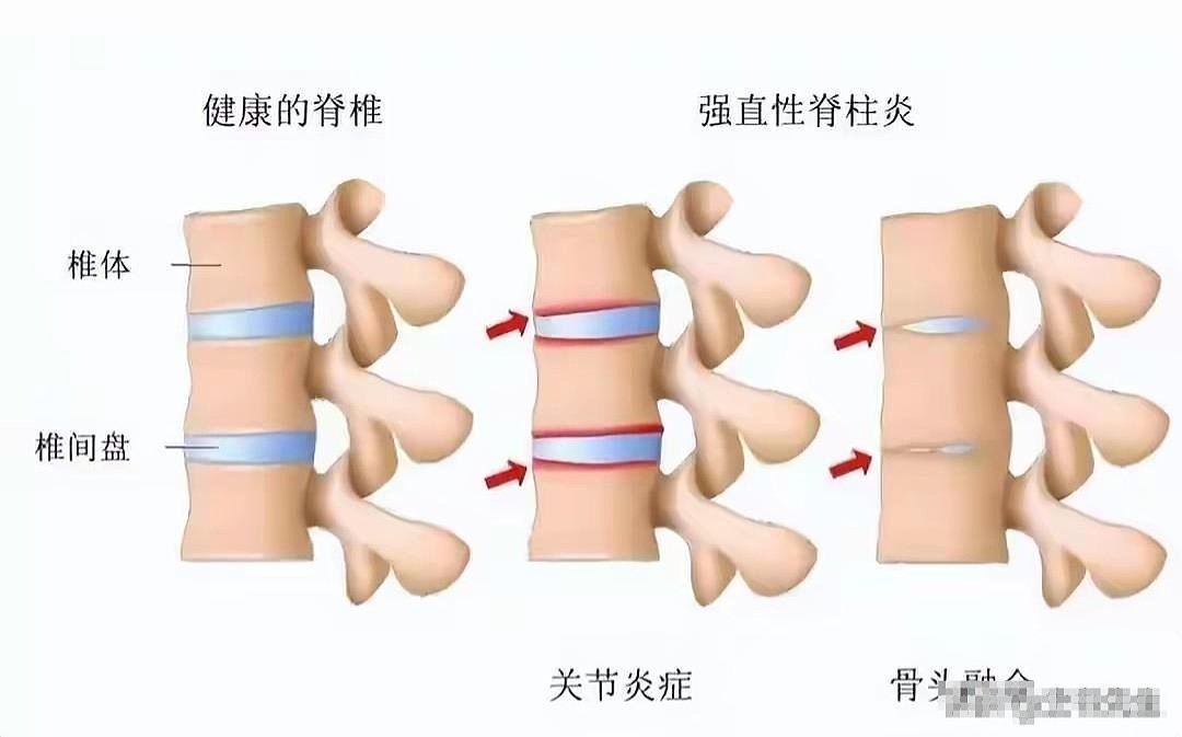 李宇春成名代价多大？隐藏身体秘密曝光，才知后遗症让她苦不堪言 - 14