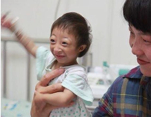 2009年，湖南女子生下2斤袖珍女婴，长相像猴子，马戏团出5万求购 - 21