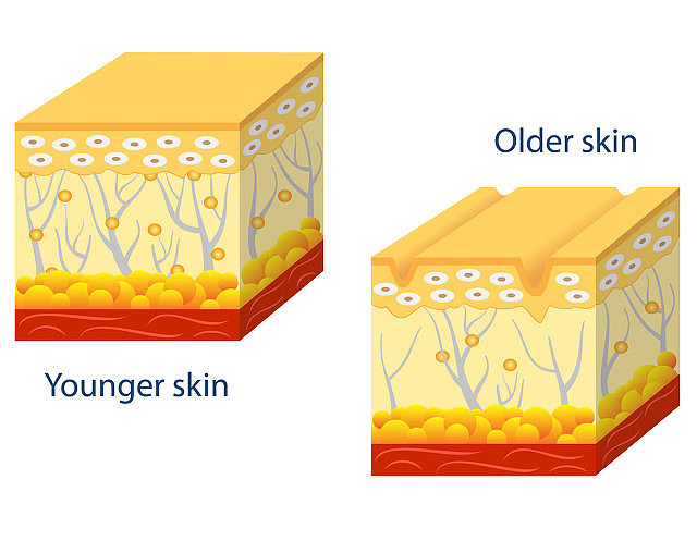 年轻皮肤和衰老皮肤图解