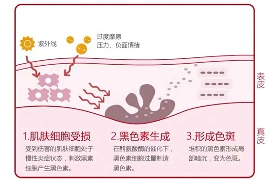 原来大家最头疼的肤色问题是这些！ - 17