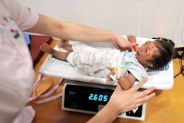2009年，湖南女子生下2斤袖珍女婴，长相像猴子，马戏团出5万求购 - 11