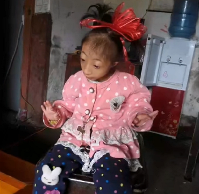 2009年，湖南女子生下2斤袖珍女婴，长相像猴子，马戏团出5万求购 - 15