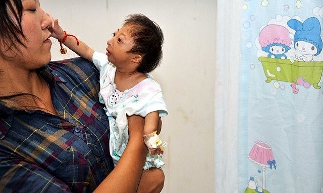 2009年，湖南女子生下2斤袖珍女婴，长相像猴子，马戏团出5万求购 - 12