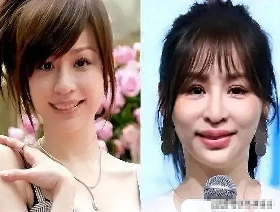 整容上瘾的6位女星，有人“换头改命”爆红，有人却断送了大好前途 - 1