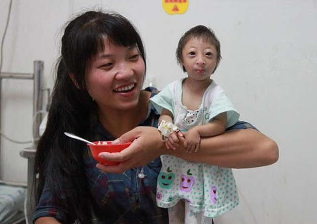 23年前，湖南女子生下重2斤的“小猴子”，马戏团出价5万求购被拒 - 2