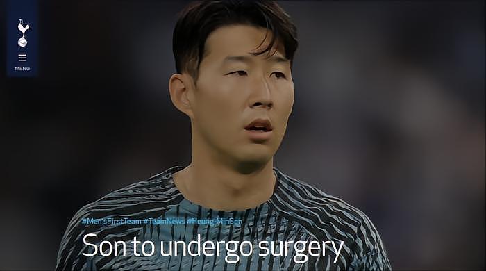 面部骨折，对于孙兴慜的世界杯会有影响吗？ - 1