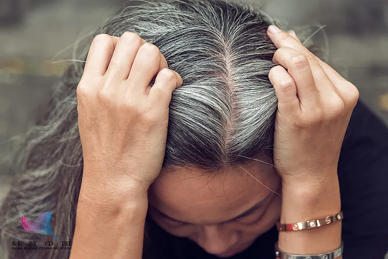 为什么压力大时会长白头发？这些习惯可能会催生白发 - 2