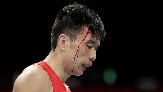 日本拳击选手被打成小夫晋级之路曾肘击中国选手