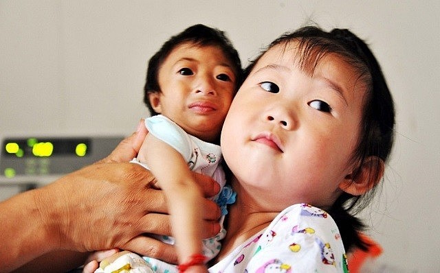 2009年，湖南女子生下2斤袖珍女婴，长相像猴子，马戏团出5万求购 - 8