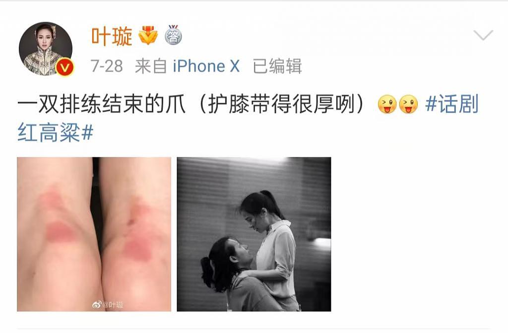 舞台意外突发，叶璇脸被刺刀戳了个洞却坚持演出 - 5