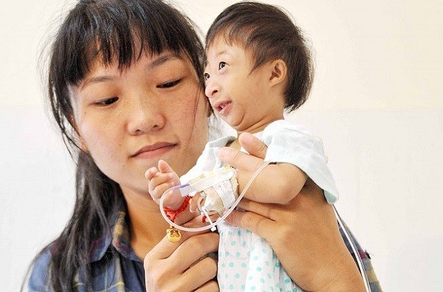 23年前，湖南女子生下重2斤的“小猴子”，马戏团出价5万求购被拒 - 3