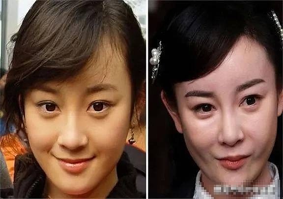 整容上瘾的6位女星，有人“换头改命”爆红，有人却断送了大好前途 - 2