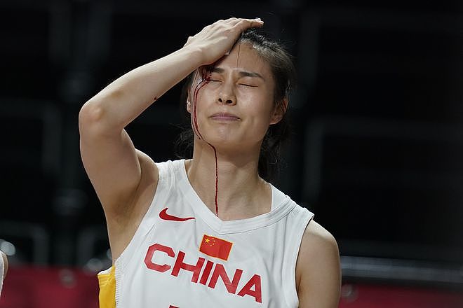 中国女篮拼字当头 王思雨血流不止3分钟重返赛场