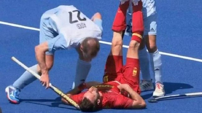 奥运赛场恶劣一幕  阿根廷球员球杆敲打对方头部 - 2