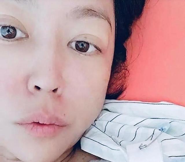 胃癌转移至卵巢，医生得出结论：47岁女演员唐玲仅剩半年寿命 - 6