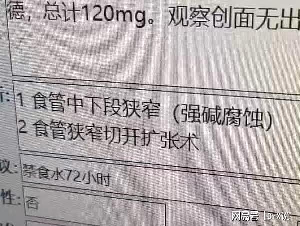 因为喝了一瓶“橙汁”，深圳21岁小伙突然暴瘦70多斤,食管细成线 - 4
