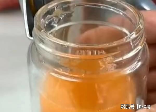 因为喝了一瓶“橙汁”，深圳21岁小伙突然暴瘦70多斤,食管细成线 - 2