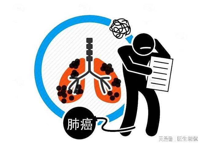 “肺癌”患者为何增多？医生告知：4件事若能避开，能预防肺病 - 1