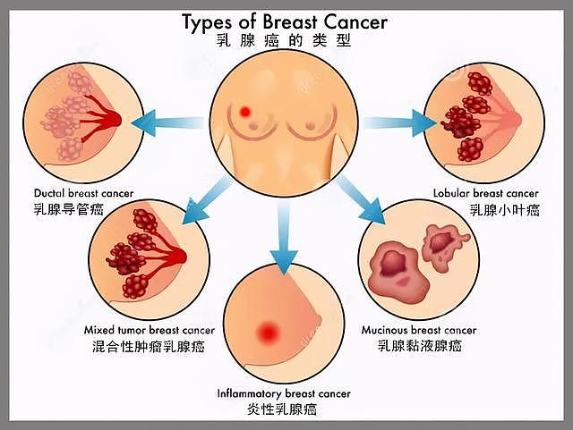 滴滴总裁柳青患乳腺癌已有五年，患上乳腺癌不等于被判“死刑” - 2
