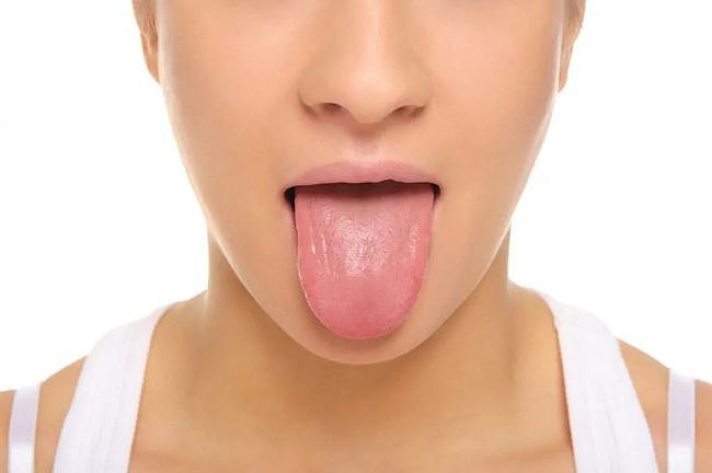 望舌探病，舌是脏腑的“本色反映”，这4种体质的人有不同的舌象 - 1