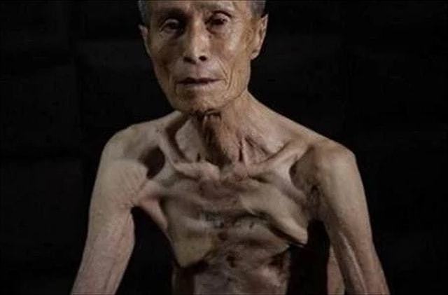 广岛核爆炸后的幸存者，绝望哭诉：美国为什么要制造这种“怪物” - 5