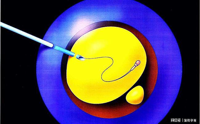 精子质量对胚胎发育的影响 - 4