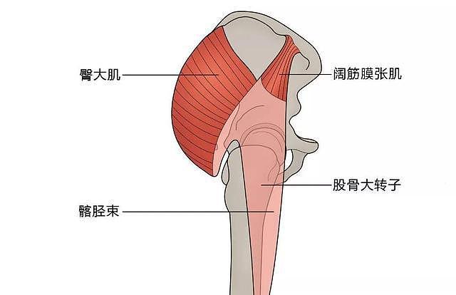什么是大转子滑囊炎？出现臀部外侧的5种疼痛，需提高警惕 - 2