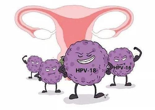 HPV病毒会“伪装”，不检查很难发现，若出现4种特征，建议早筛查 - 5