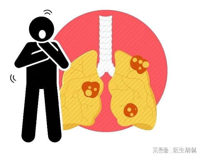 世界防治结核病日：能让文人追捧的肺结核，究竟是一种怎样的疾病 - 4