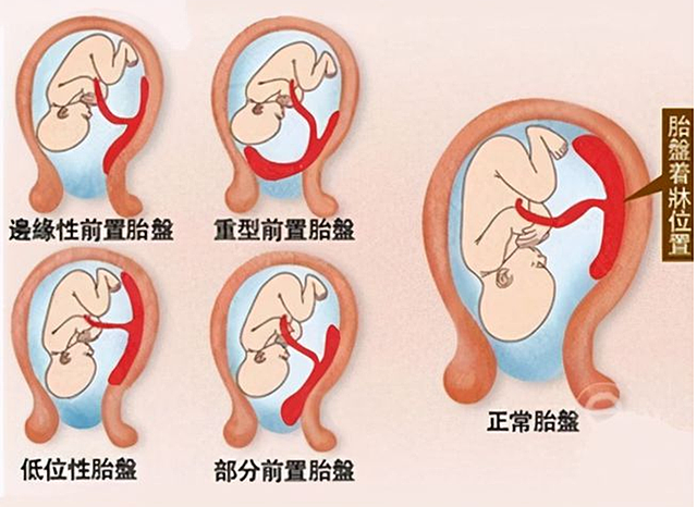 怀孕后如果是这三种“体型”，说明胎儿状况良好，孕妈不用担心 - 4