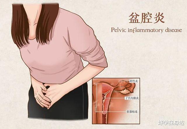 女性肚子经常痛，可能是慢性盆腔炎 - 1