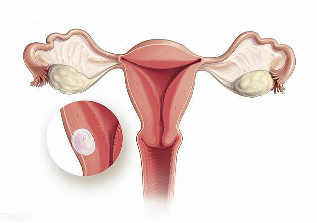了解一下：无创、安全、准确性高的子宫输卵管超声造影 - 1
