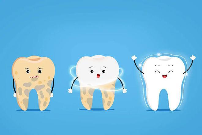 牙结石或会影响全身健康，提示：这3类人最好抓紧时间洗牙 - 1