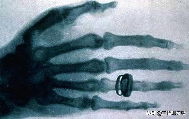 江苏女生在民营医院拍X光，被医生要求脱光上衣！真的有必要吗？ - 3