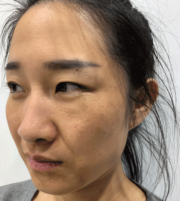 皮肤科医生揭秘：药店有一种擦脸的，16天淡色斑，可惜很少人知道！ - 31
