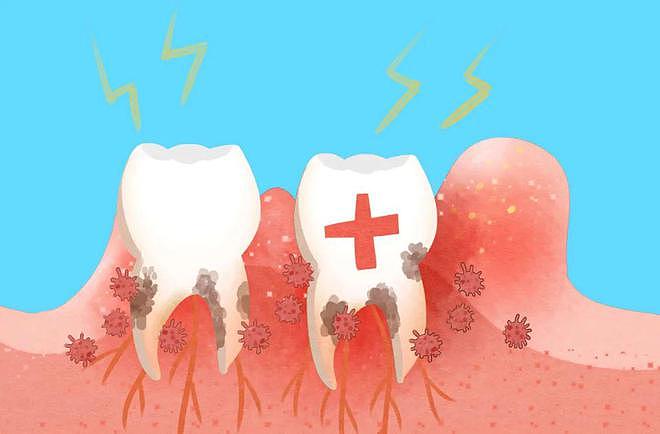 牙龈出血很正常，但有一种人，牙龈出血可能会引发致命危害 - 1