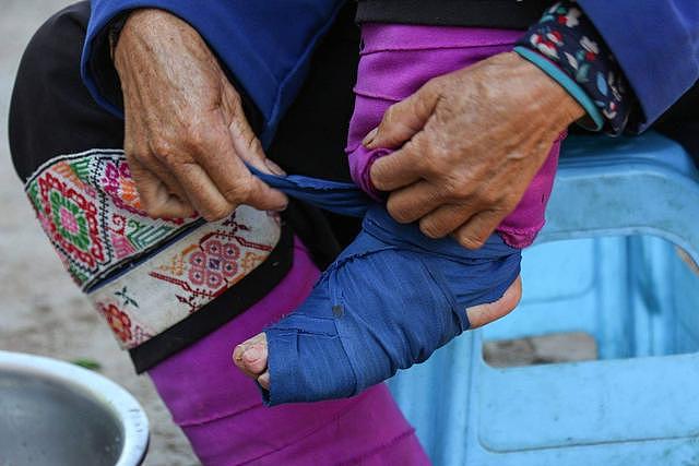 中国最后一位裹脚女性，15岁靠三寸金莲嫁大户，洗脚时钻心痛 - 3