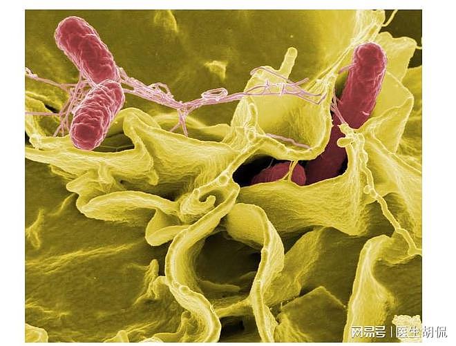 西班牙新增2例沙门氏菌感染病例！肾病患者注意：这些食物别吃 - 1