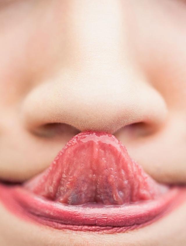 如何检查自己是否有癌症前兆？医生：看舌头！这4种舌象要注意 - 3